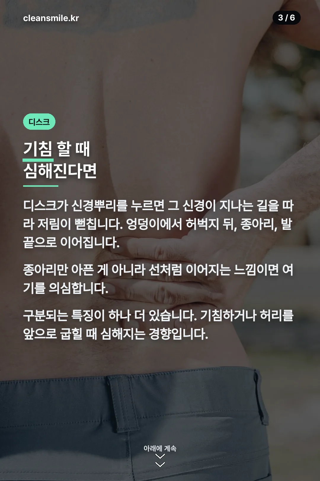 허리디스크 방사통