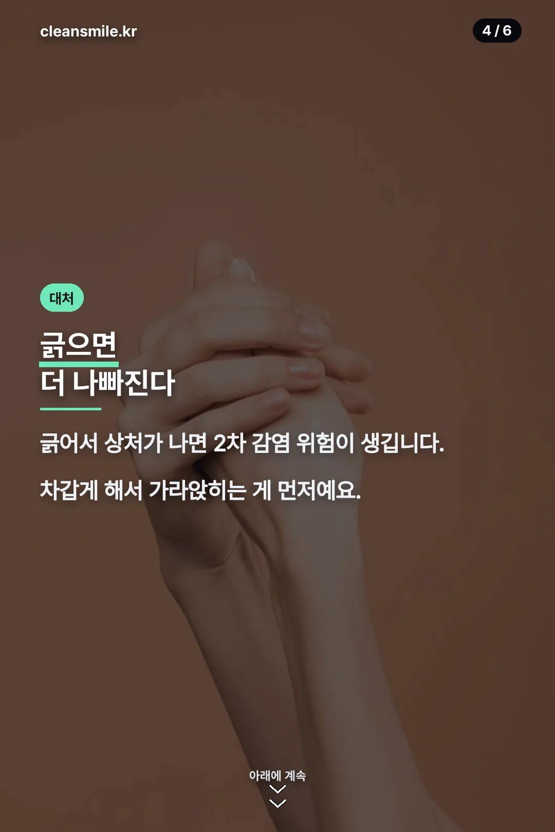 긁지 않기