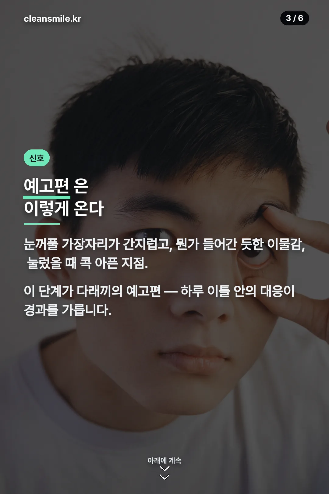 예고편 단계