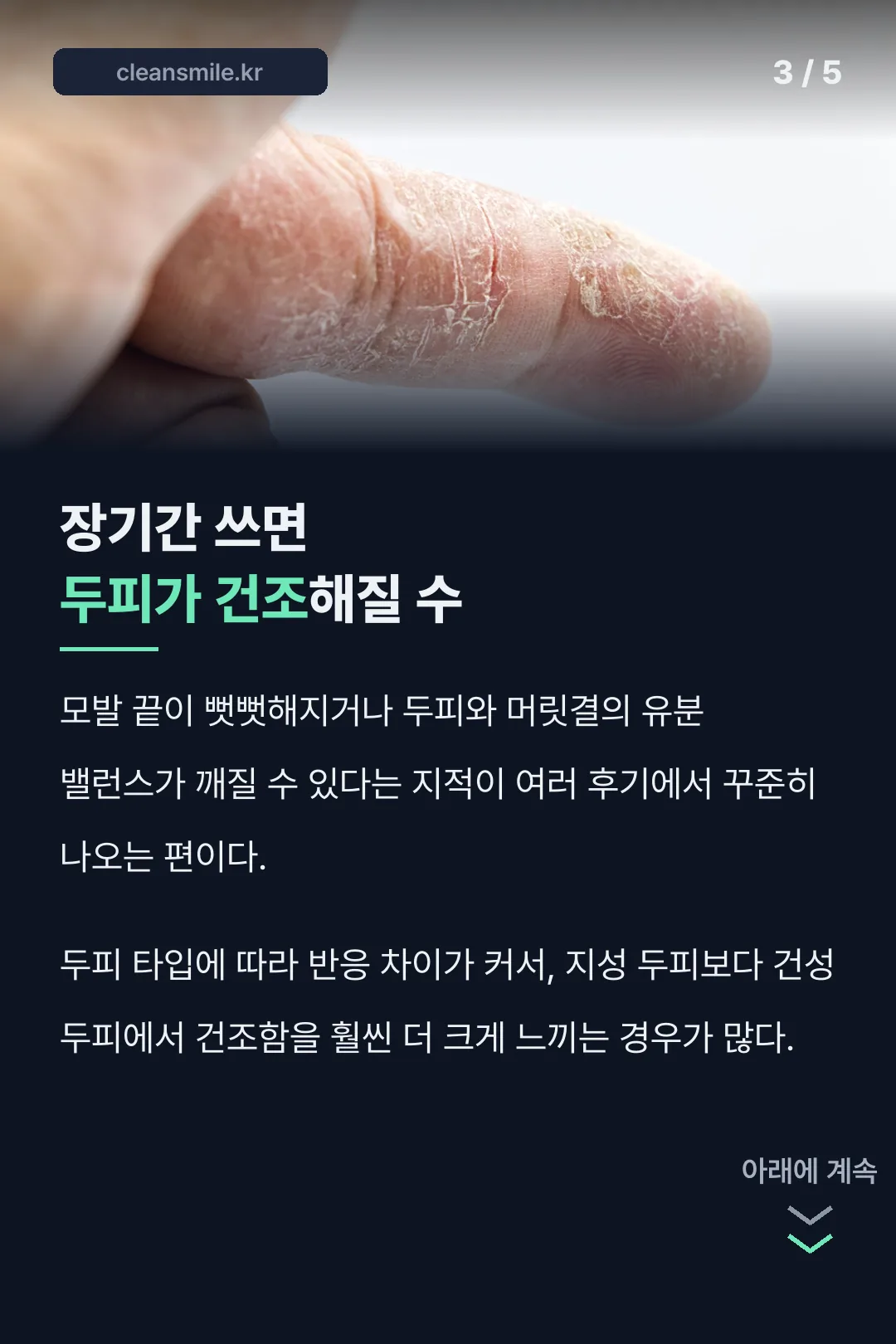 두피 건조 지적