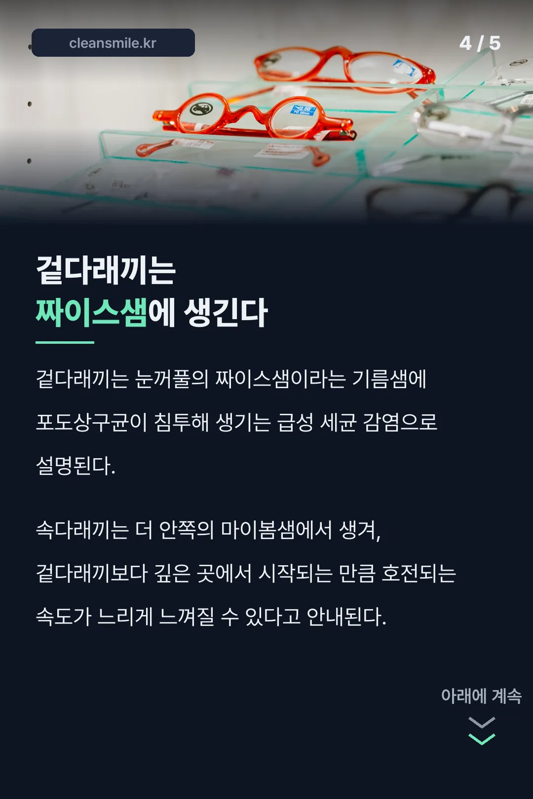 짜이스샘·마이봄샘 비교