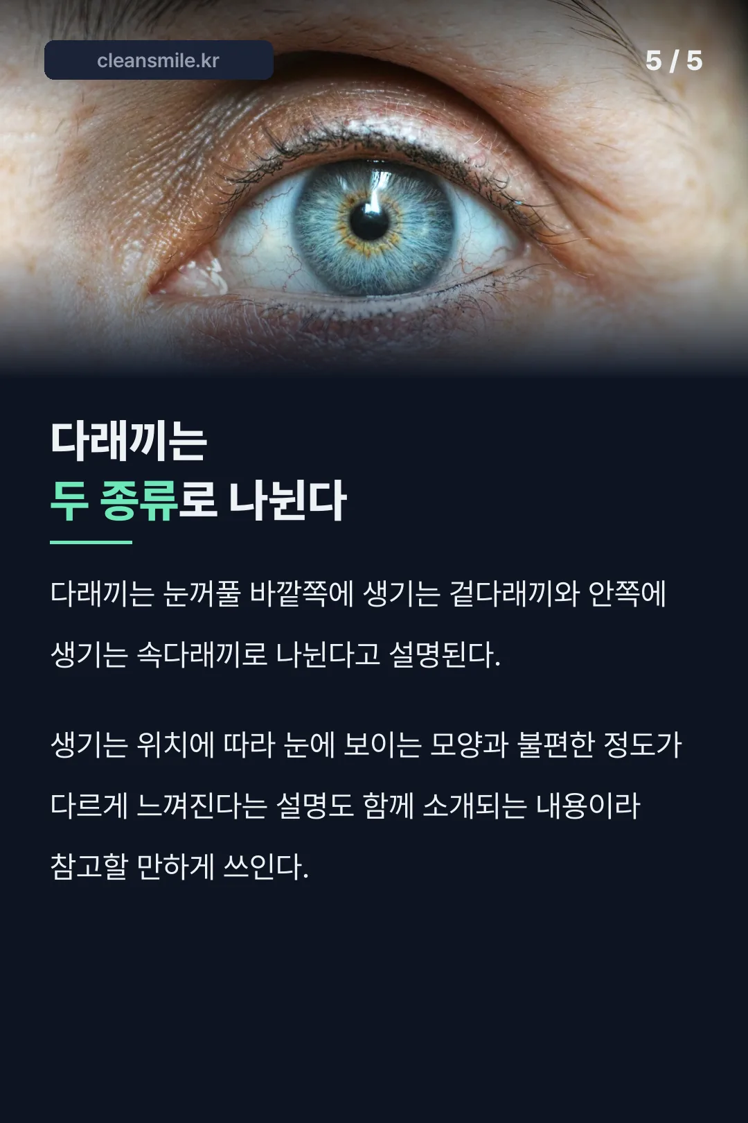 겉다래끼 속다래끼 구분