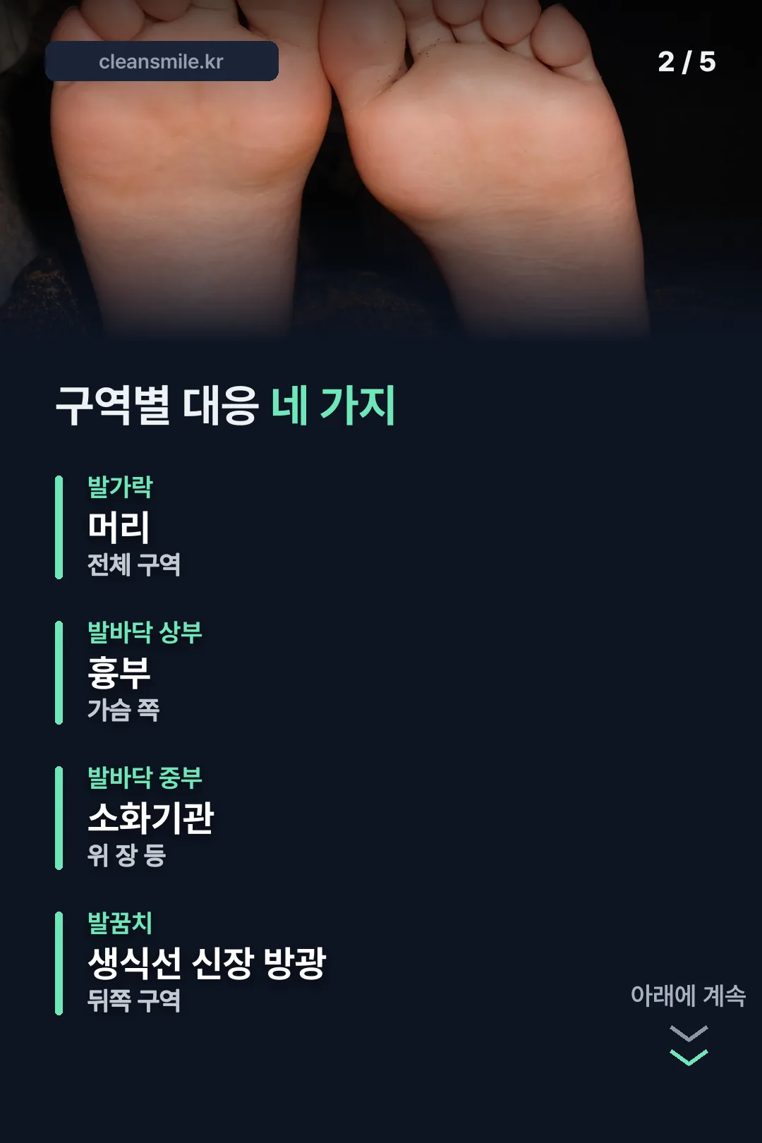 구역별 대응 네 가지