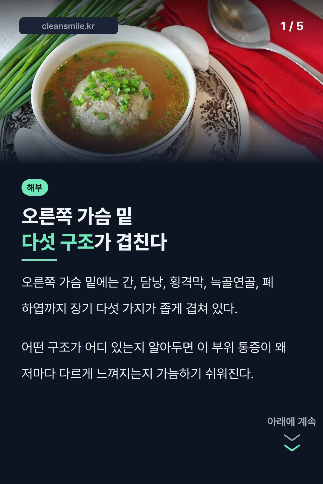 오른쪽 가슴 밑 다섯 구조가 겹친다