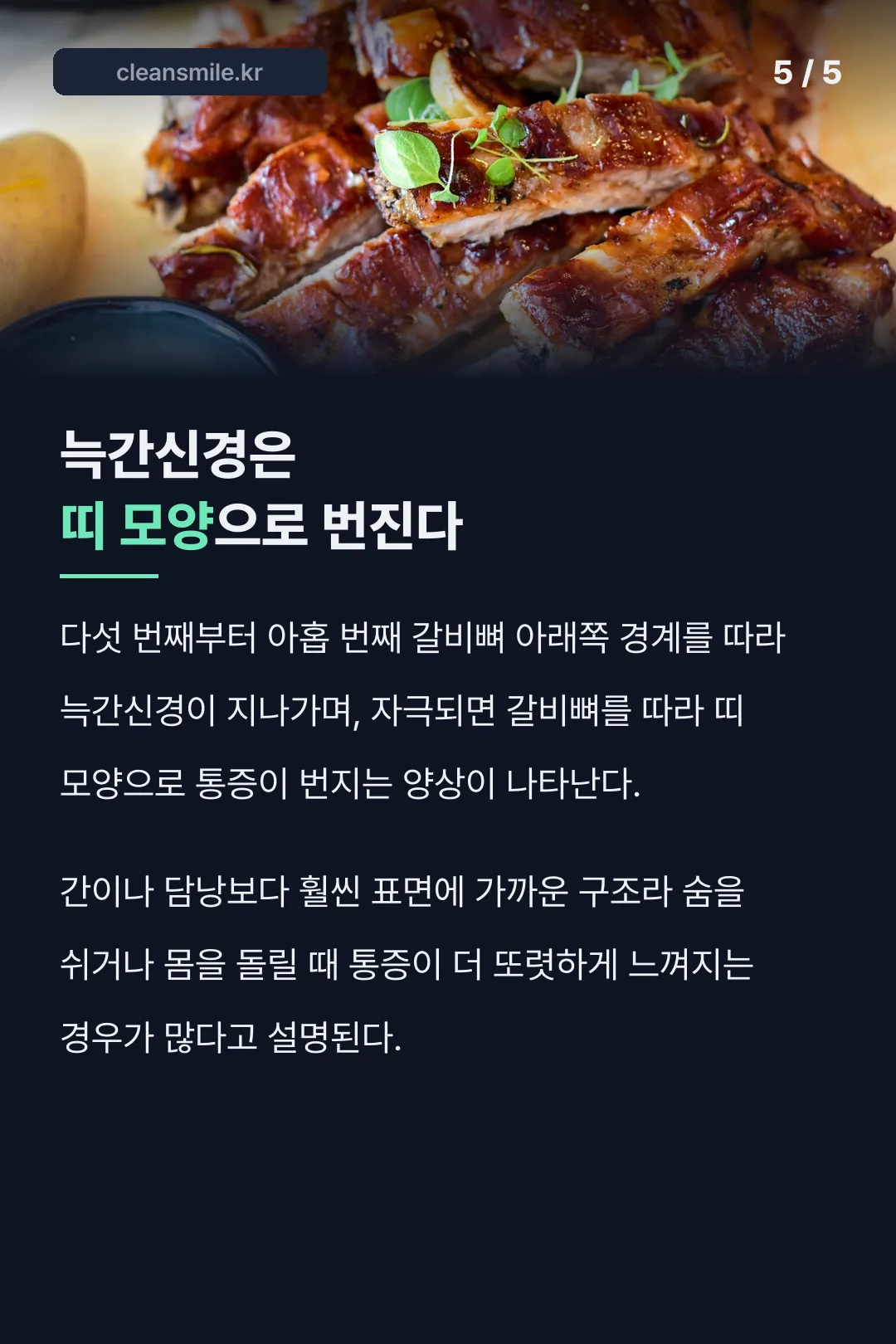 늑간신경은 띠 모양으로 번진다