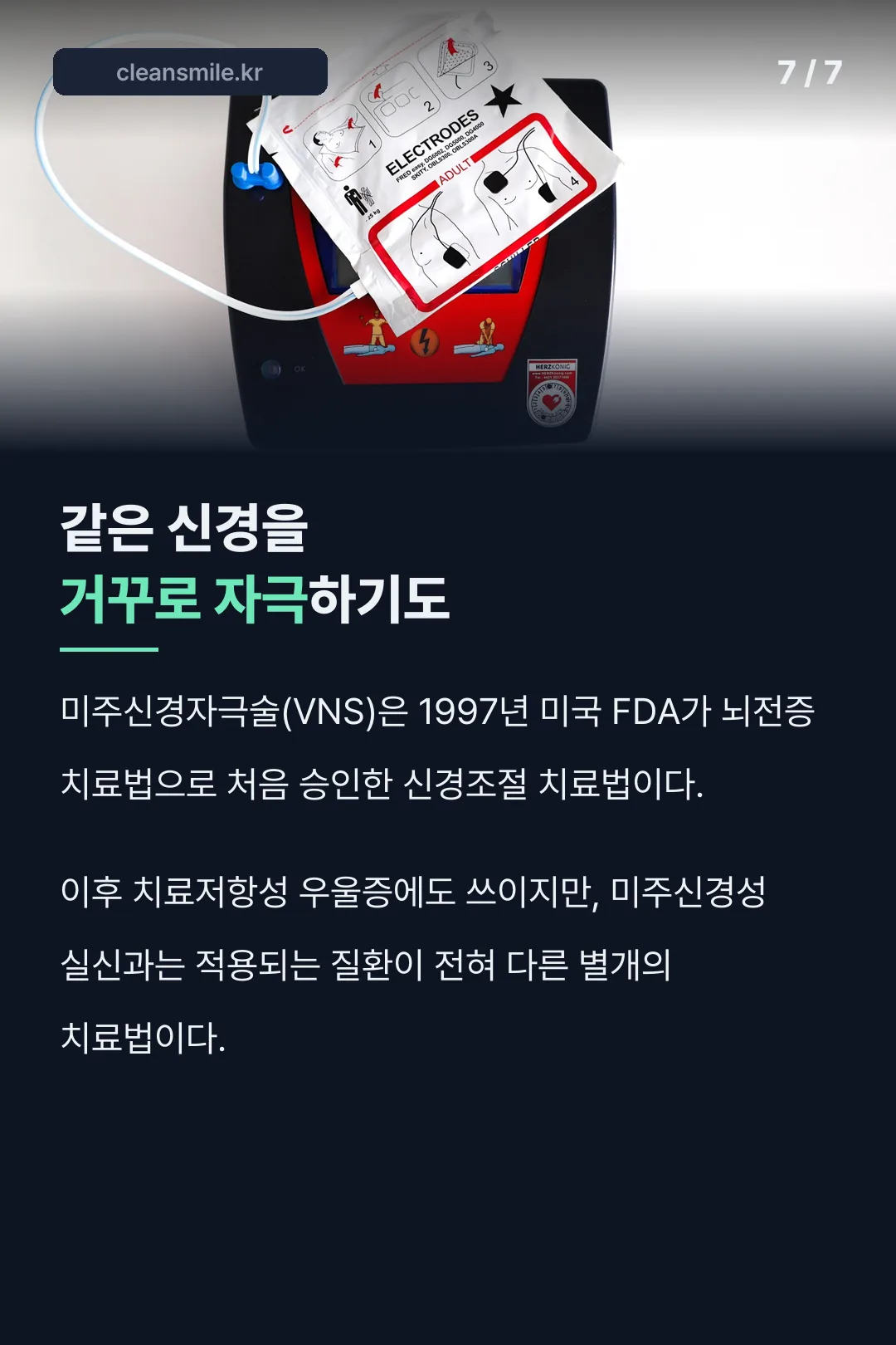 미주신경자극술 비교 설명